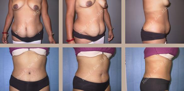 Beverly Hills Plastic Surgery gallery image 69