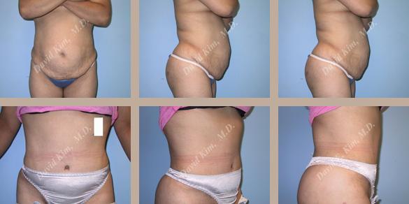 Beverly Hills Plastic Surgery gallery image 70
