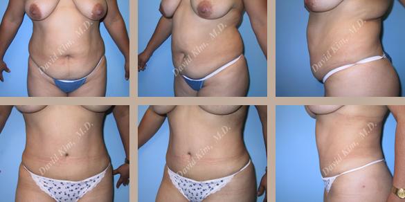 Beverly Hills Plastic Surgery gallery image 71