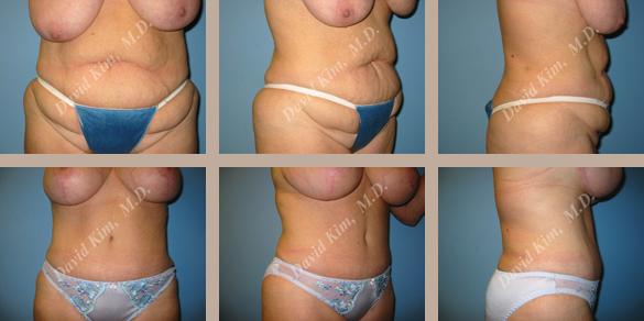 Beverly Hills Plastic Surgery gallery image 72