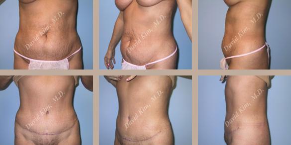 Beverly Hills Plastic Surgery gallery image 73