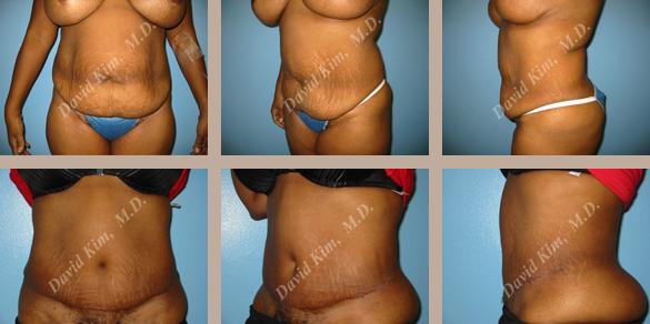 Beverly Hills Plastic Surgery gallery image 74