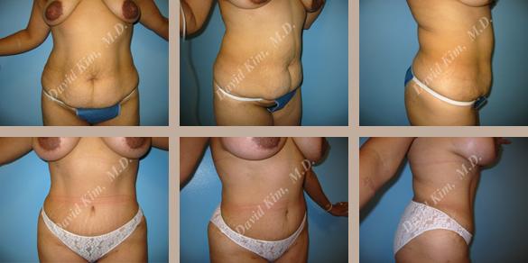 Beverly Hills Plastic Surgery gallery image 75