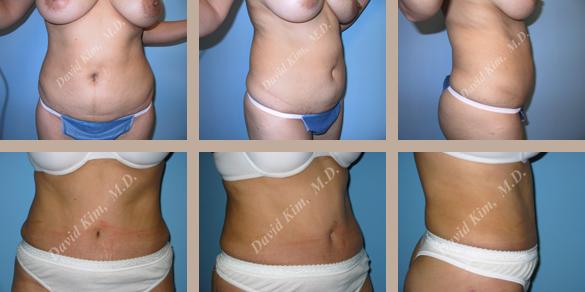 Beverly Hills Plastic Surgery gallery image 76