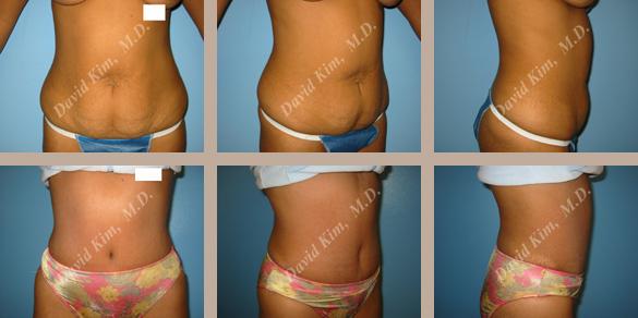 Beverly Hills Plastic Surgery gallery image 77