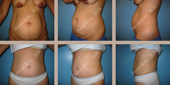 Beverly Hills Plastic Surgery gallery image 79
