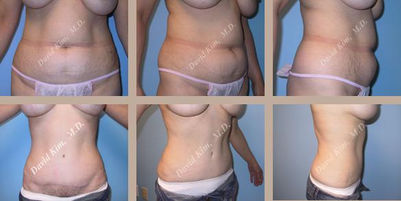 Beverly Hills Plastic Surgery gallery image 80