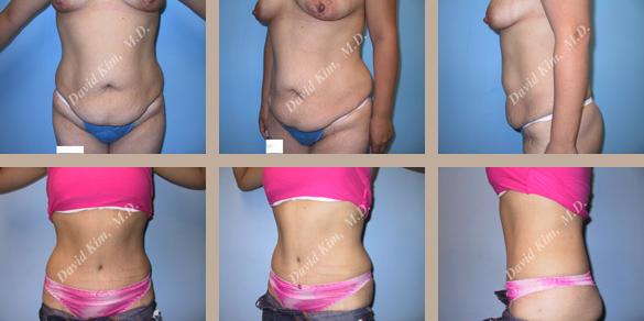 Beverly Hills Plastic Surgery gallery image 81