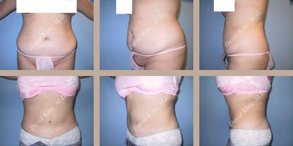 Beverly Hills Plastic Surgery gallery image 82