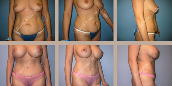 Beverly Hills Plastic Surgery gallery image 84