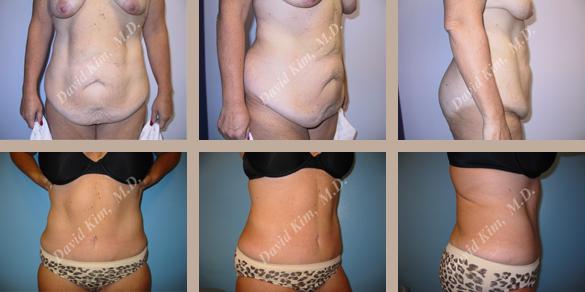 Beverly Hills Plastic Surgery gallery image 85