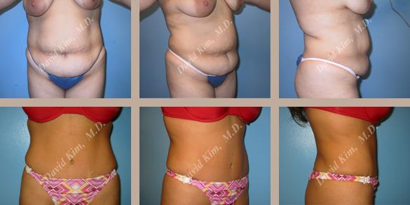 Beverly Hills Plastic Surgery gallery image 86
