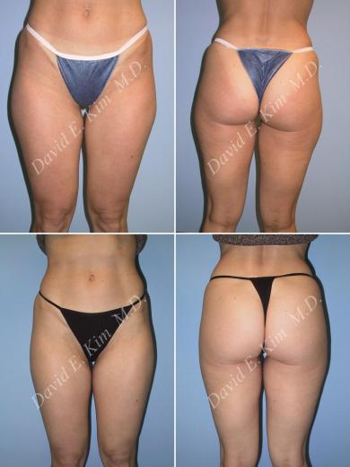 Beverly Hills Plastic Surgery gallery image 87