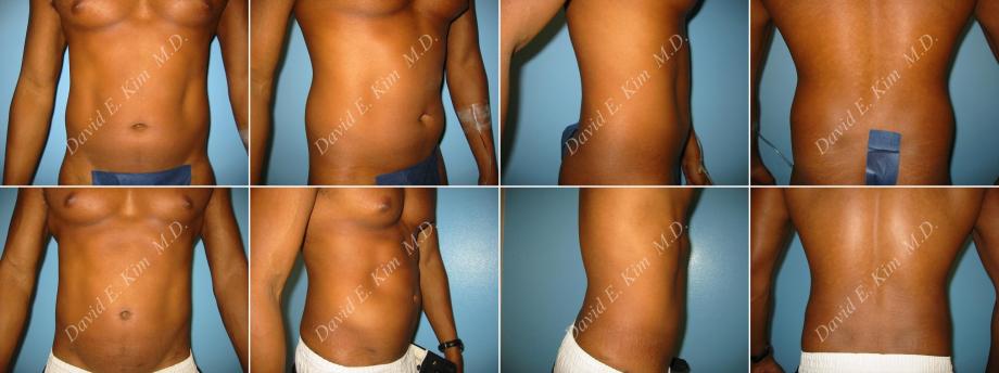 Beverly Hills Plastic Surgery gallery image 88