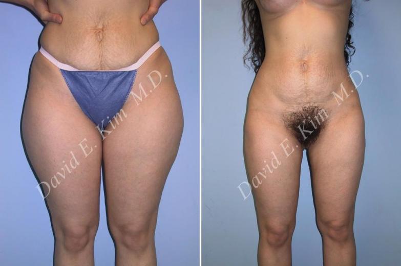 Beverly Hills Plastic Surgery gallery image 91
