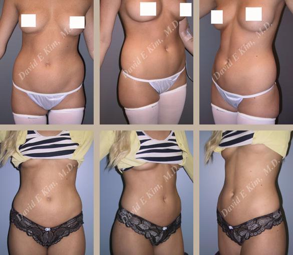 Beverly Hills Plastic Surgery gallery image 92