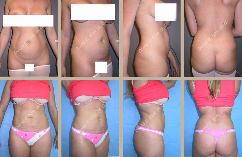 Beverly Hills Plastic Surgery gallery image 93