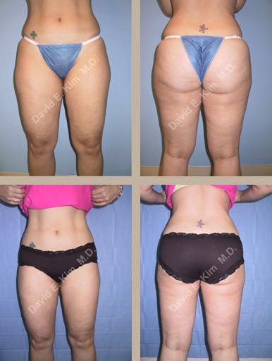 Beverly Hills Plastic Surgery gallery image 94