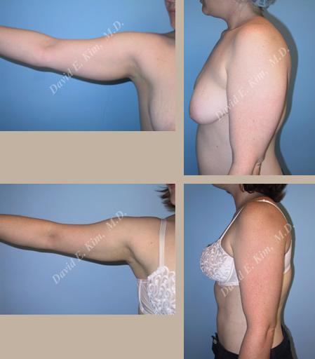 Beverly Hills Plastic Surgery gallery image 95