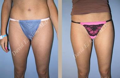 Beverly Hills Plastic Surgery gallery image 97