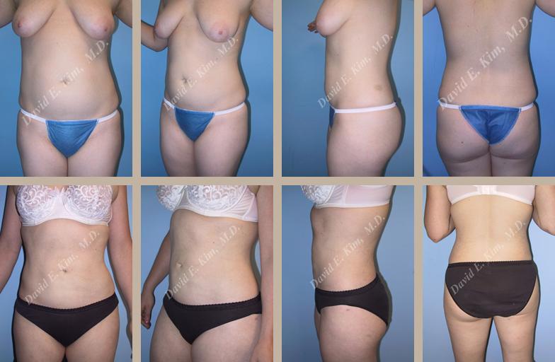 Beverly Hills Plastic Surgery gallery image 99