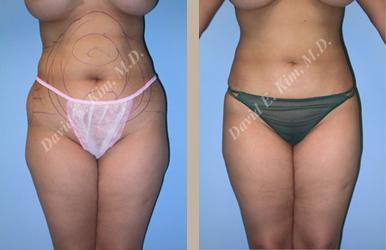 Beverly Hills Plastic Surgery gallery image 100