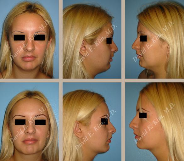 Beverly Hills Plastic Surgery gallery image 102
