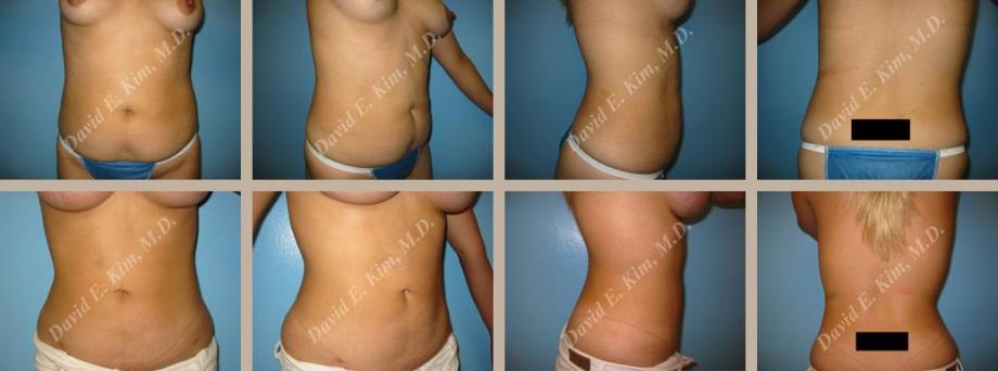 Beverly Hills Plastic Surgery gallery image 103