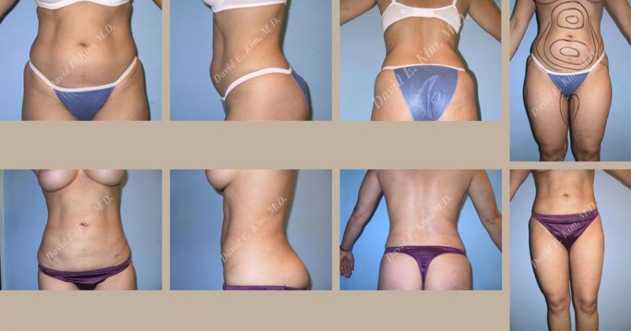Beverly Hills Plastic Surgery gallery image 105