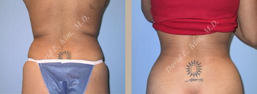 Beverly Hills Plastic Surgery gallery image 106
