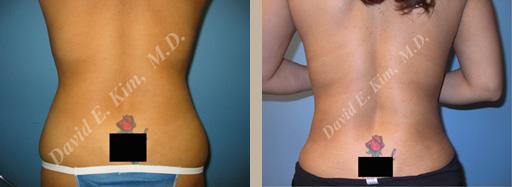 Beverly Hills Plastic Surgery gallery image 107