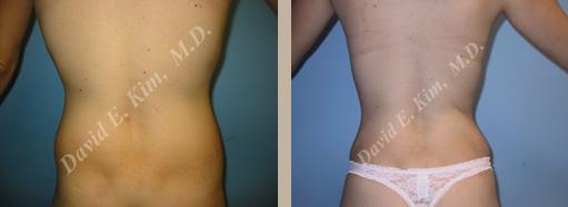 Beverly Hills Plastic Surgery gallery image 108