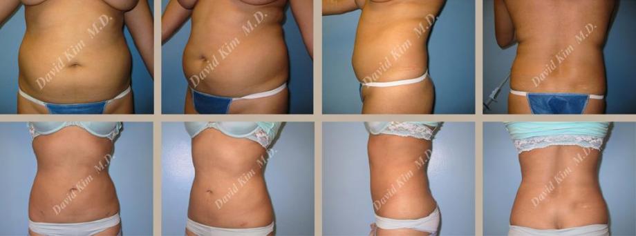 Beverly Hills Plastic Surgery gallery image 109