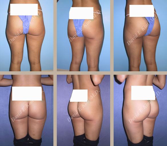 Beverly Hills Plastic Surgery gallery image 110