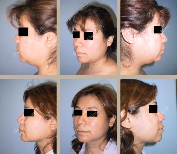 Beverly Hills Plastic Surgery gallery image 111