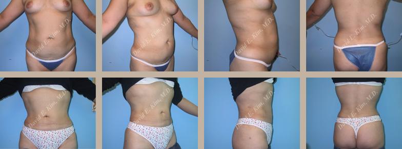 Beverly Hills Plastic Surgery gallery image 112
