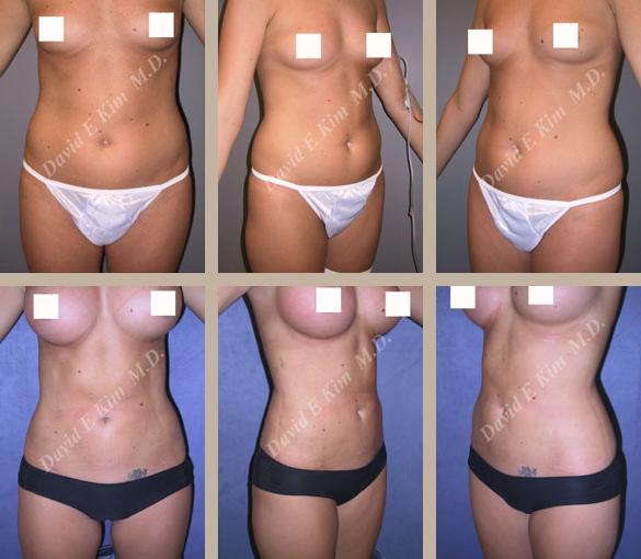 Beverly Hills Plastic Surgery gallery image 113