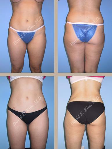 Beverly Hills Plastic Surgery gallery image 114