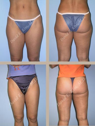Beverly Hills Plastic Surgery gallery image 115