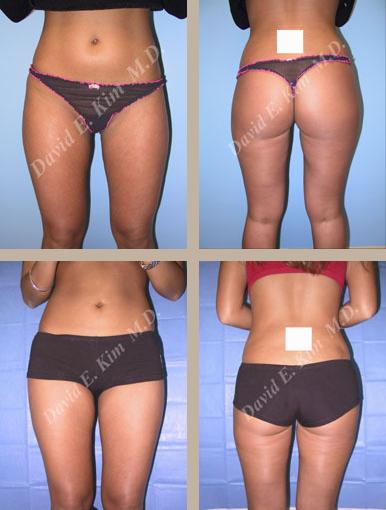 Beverly Hills Plastic Surgery gallery image 117