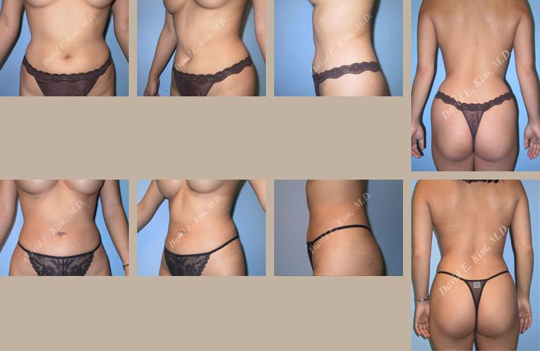 Beverly Hills Plastic Surgery gallery image 118