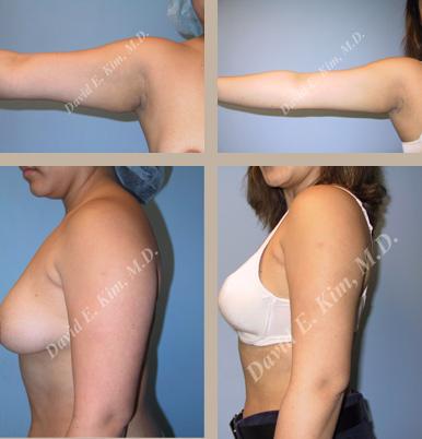 Beverly Hills Plastic Surgery gallery image 119