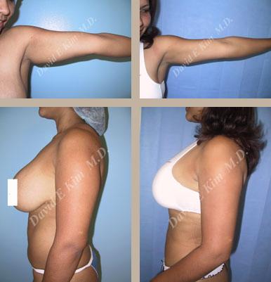 Beverly Hills Plastic Surgery gallery image 121