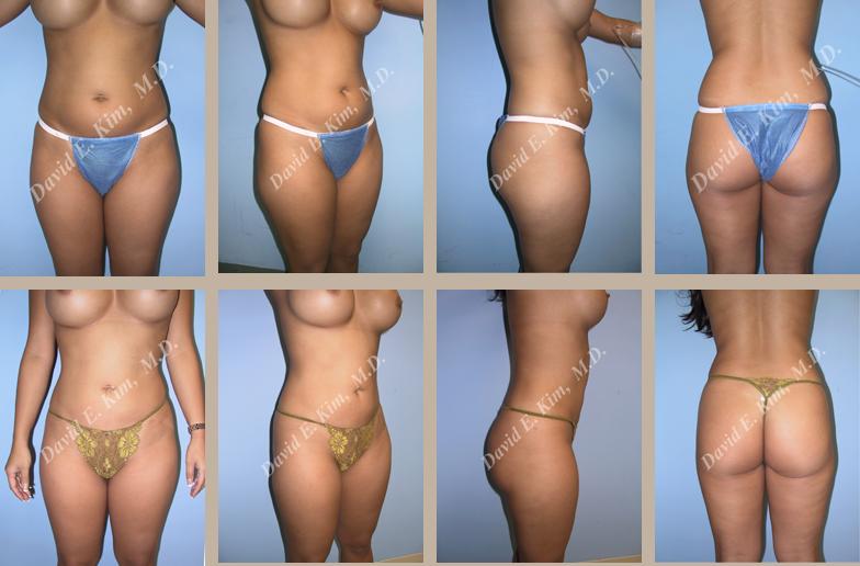 Beverly Hills Plastic Surgery gallery image 122