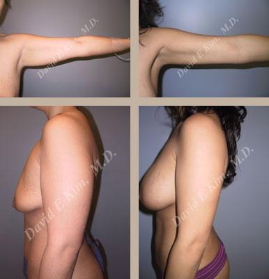 Beverly Hills Plastic Surgery gallery image 124