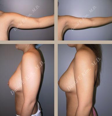 Beverly Hills Plastic Surgery gallery image 125