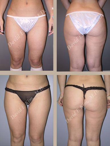Beverly Hills Plastic Surgery gallery image 126