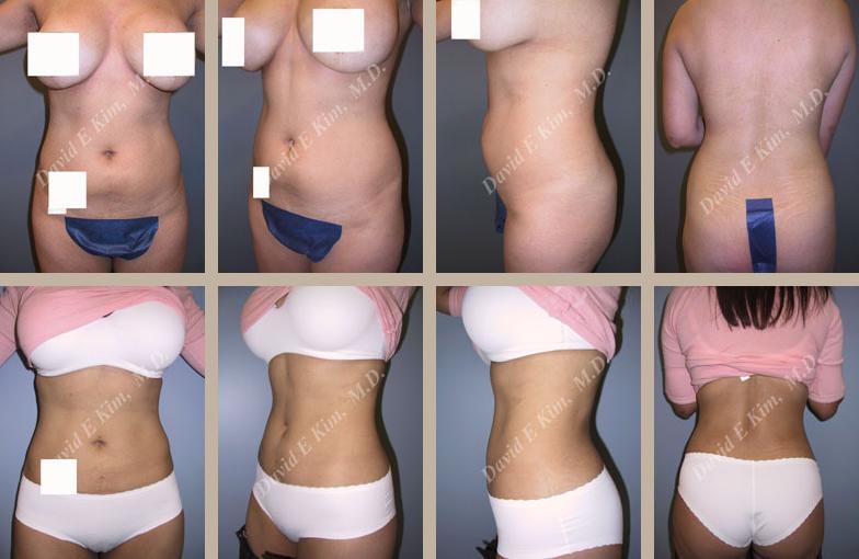 Beverly Hills Plastic Surgery gallery image 127