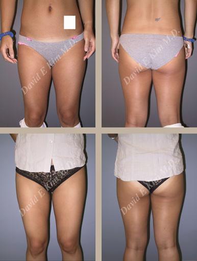 Beverly Hills Plastic Surgery gallery image 128
