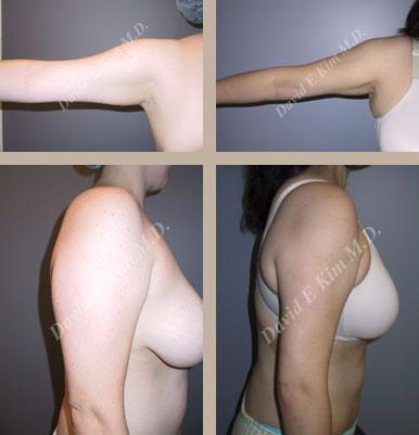 Beverly Hills Plastic Surgery gallery image 129
